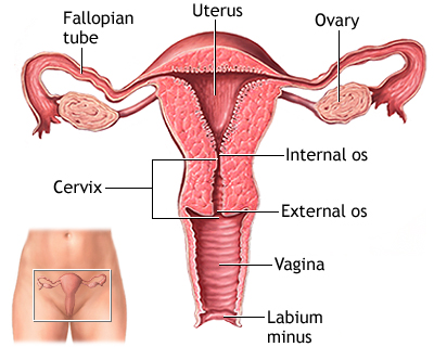 Preventing Cancer by removing ovaries and uterus
