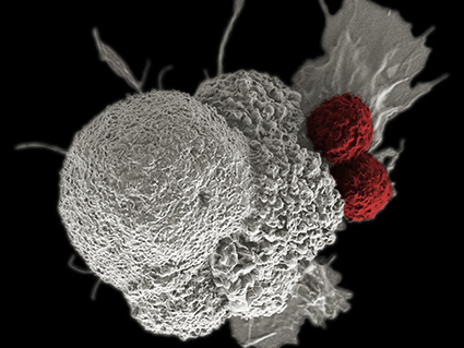 Oral squamous cancer cell