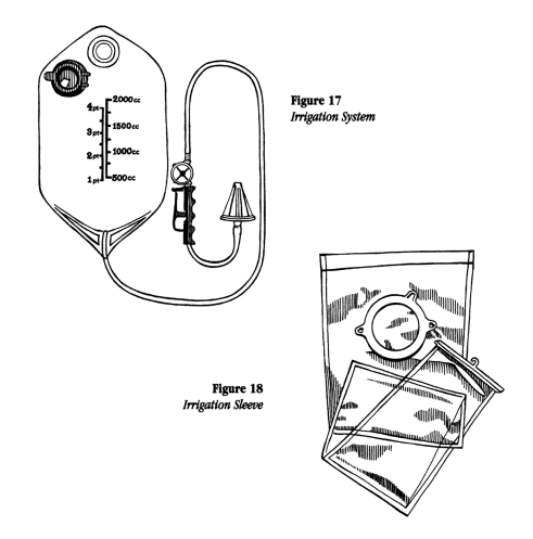 illustration showing an irrigation system and sleeve