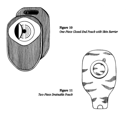 illustration showing two types of pouching systems: a one-piece closed-end pouch with skin barrier and a two-piece drainable pouch